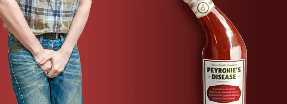 Peyronijeva bolest naslovna slika